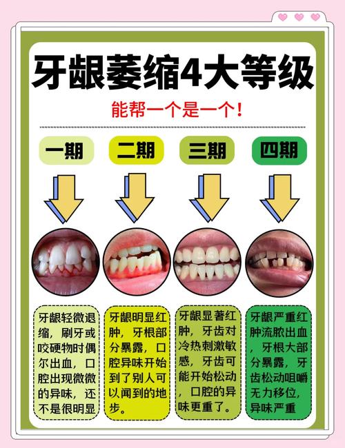牙龈出血补硒