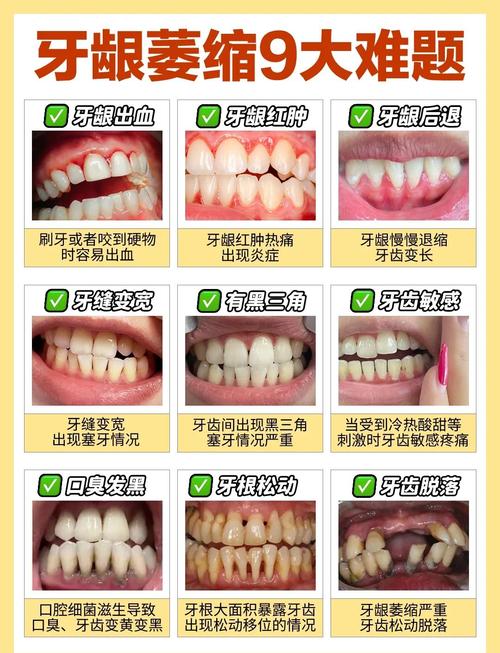 牙龈出血补硒
