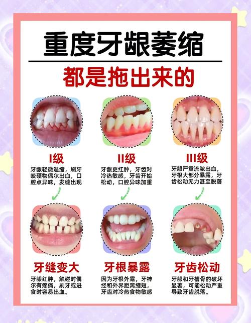 牙龈出血补硒