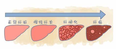 乙肝怎样补硒