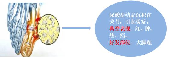 补硒防治痛风