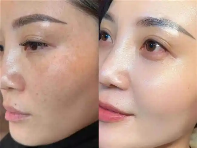 孕妇补硒方法