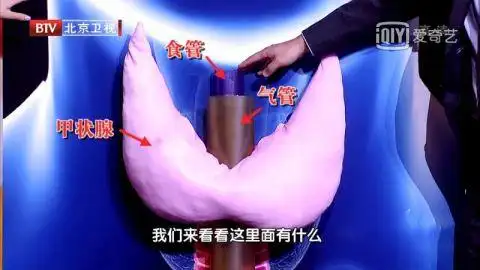 桥本结节补硒