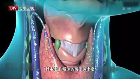 桥本结节补硒