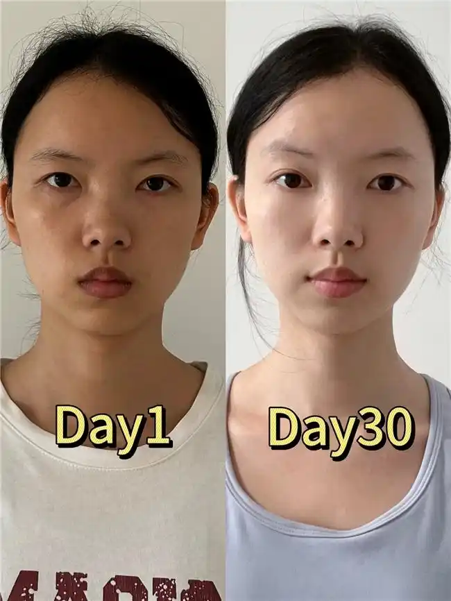 癌症补硒案例