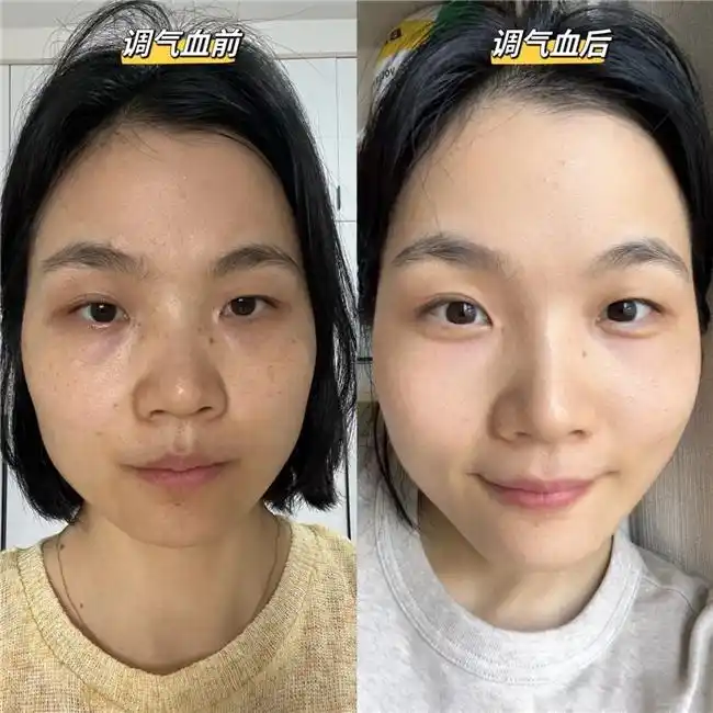 癌症补硒案例
