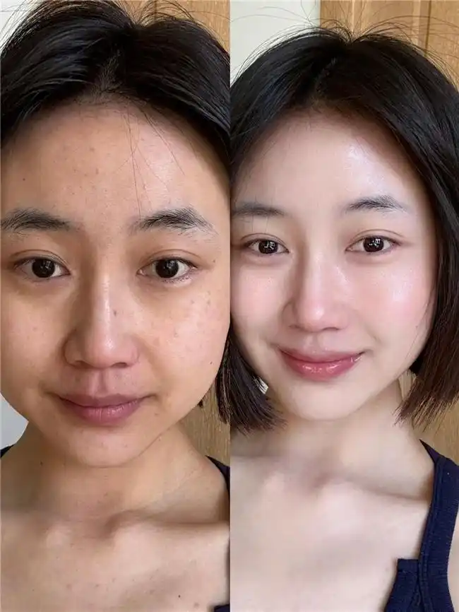 癌症补硒案例