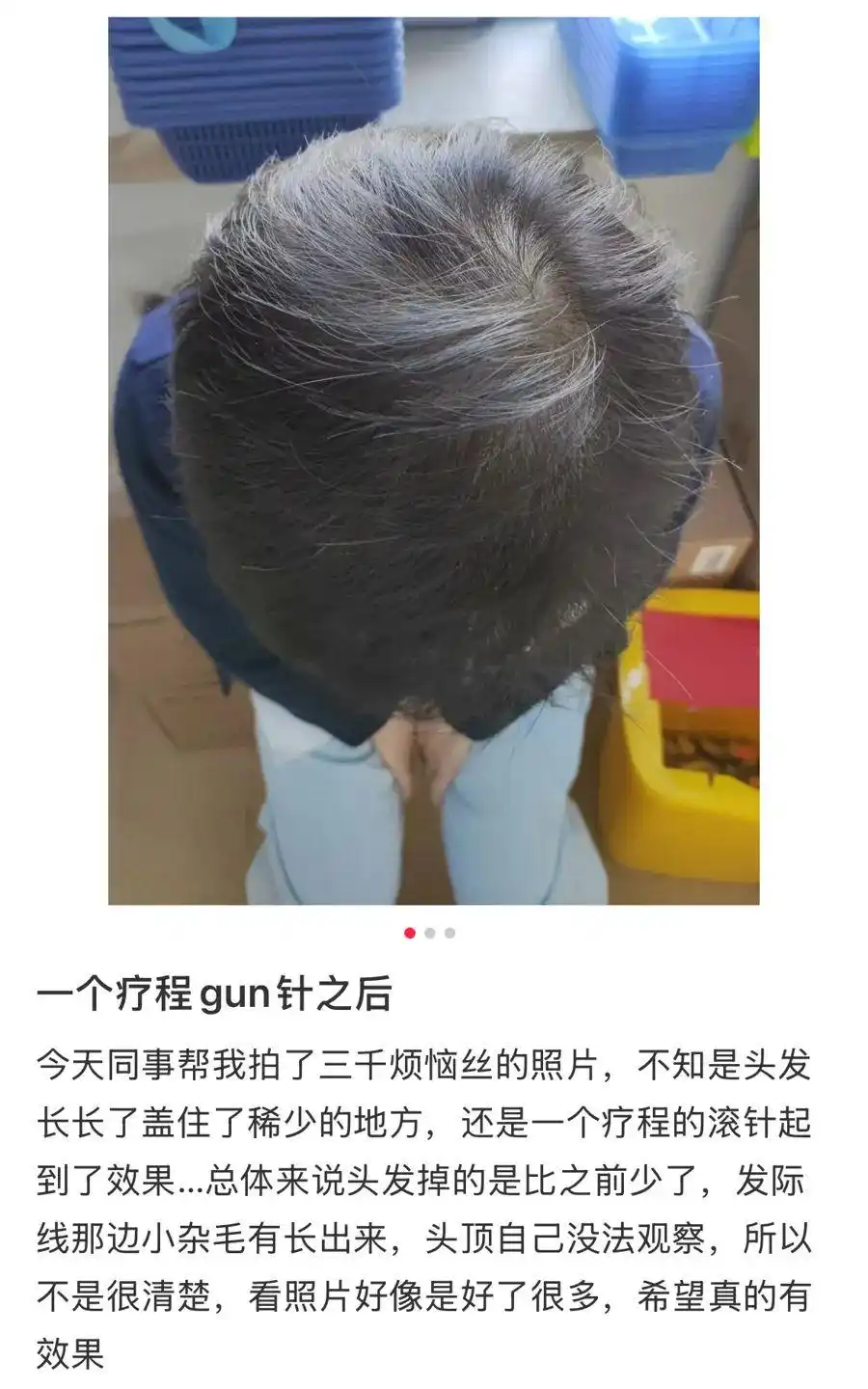 补硒减少脱发