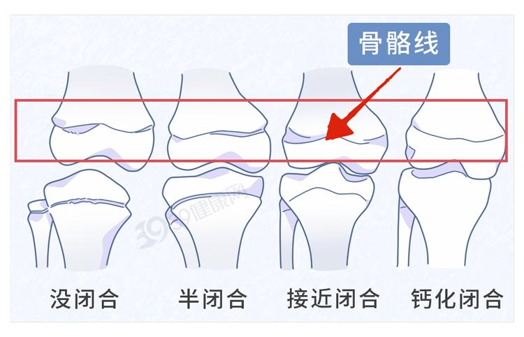 补硒能致癌吗