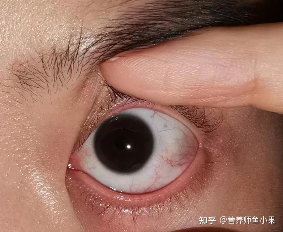 眼睛补硒价格