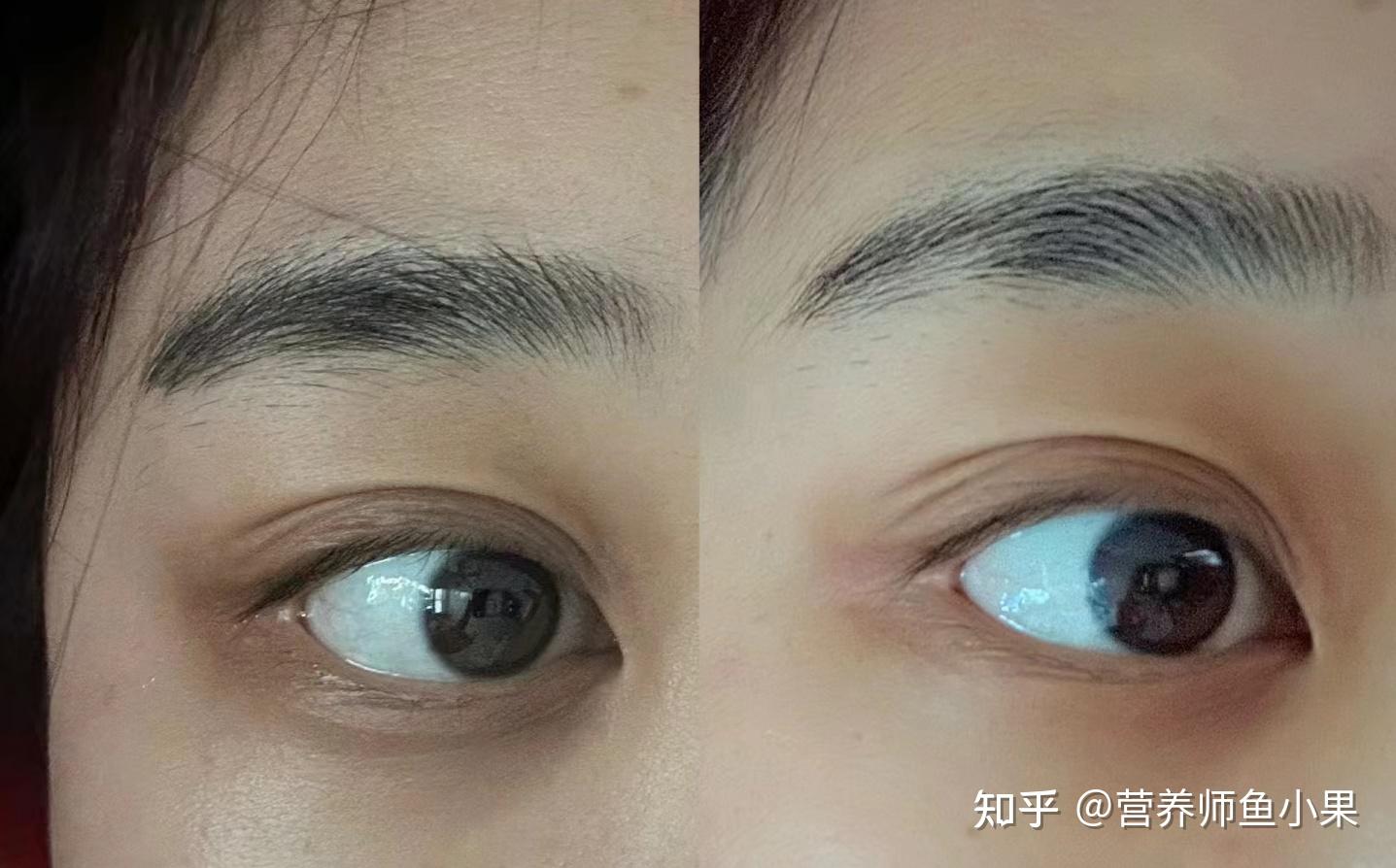 眼睛补硒价格