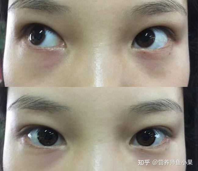 眼睛补硒价格