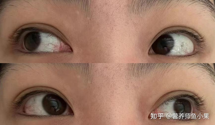 眼睛补硒价格