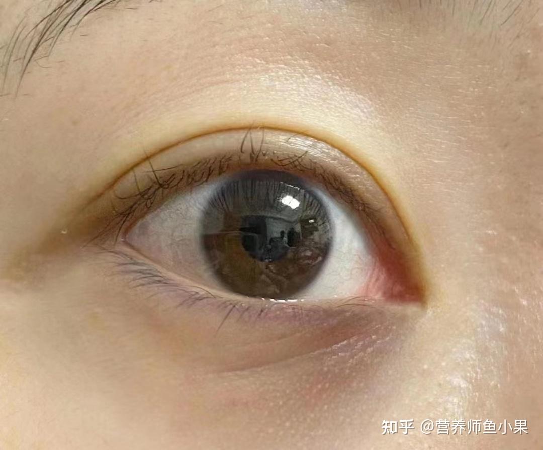 眼睛补硒价格