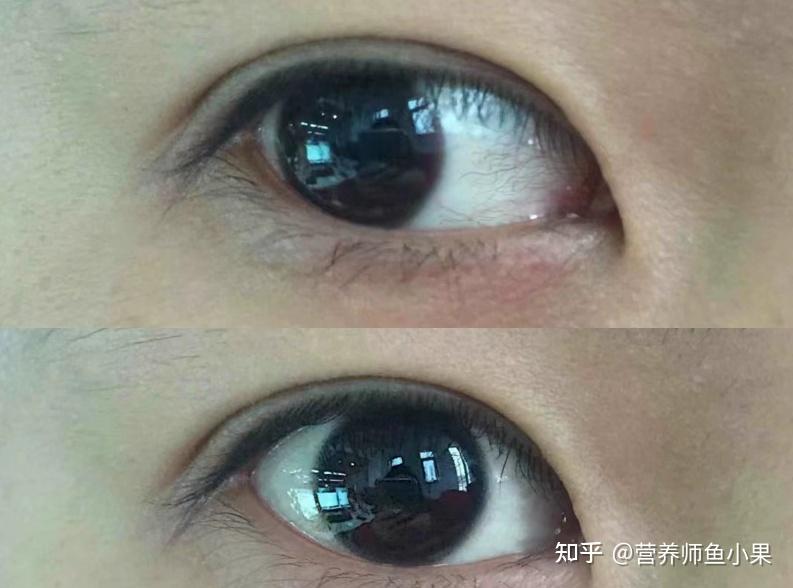 眼睛补硒价格