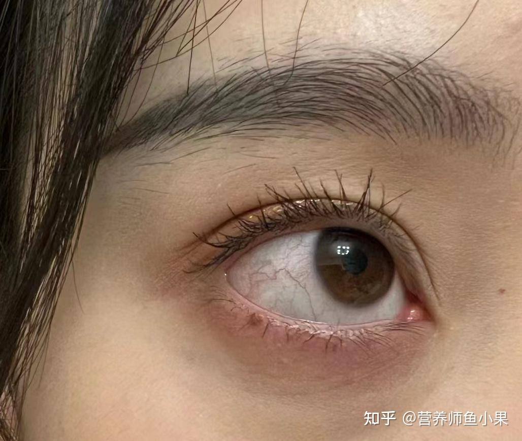 眼睛补硒价格
