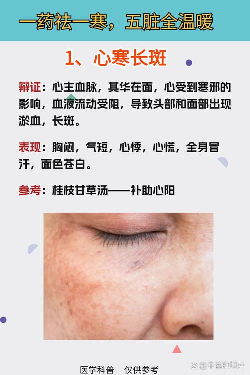 补硒导致长斑