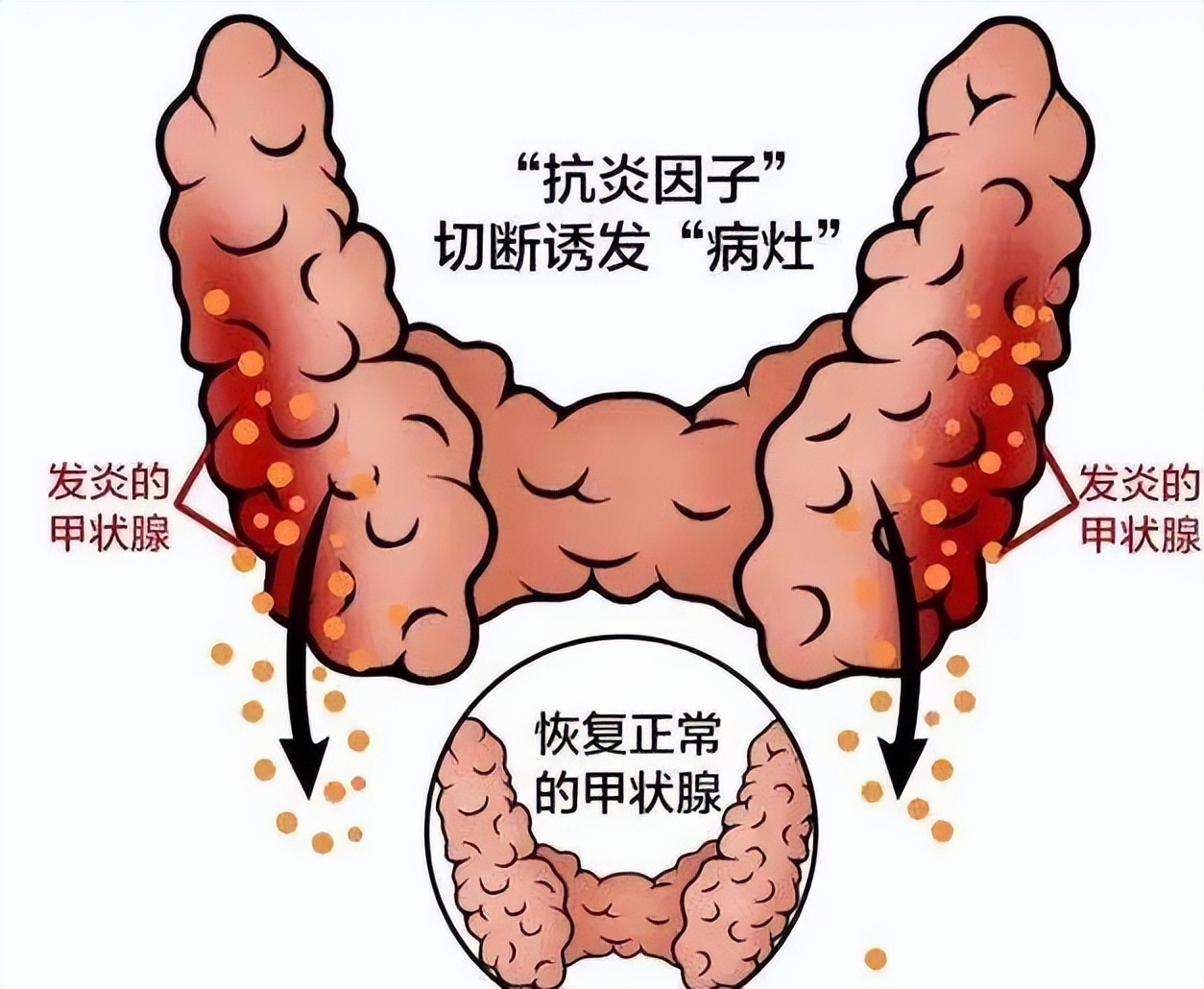 硒酵母补肺吗