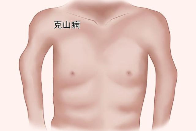 补硒排毒表现