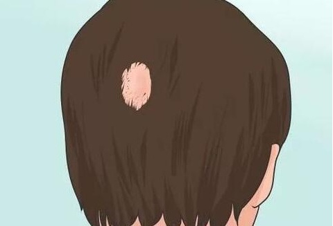 补硒会生发吗()-硒宝网