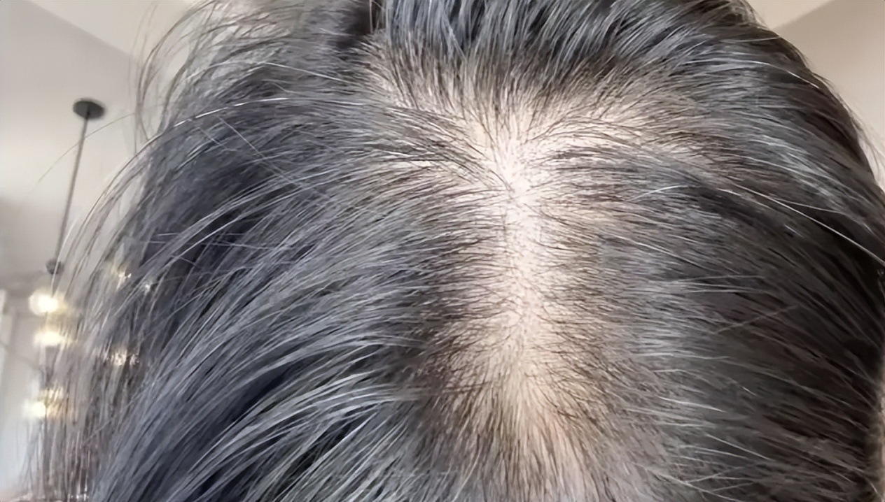 玉米能补硒吗(紫甘蓝甲状腺)-硒宝网