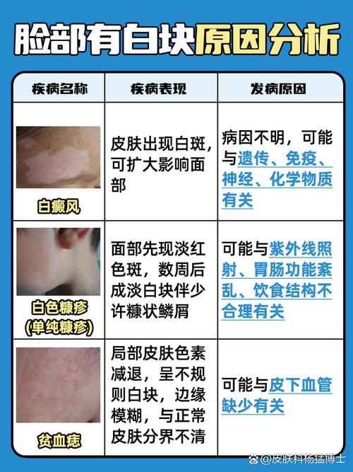 补硒 皮肤病(硒与白癜风)-硒宝网