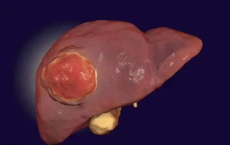 每回日补硒量（硒的抗癌作用）-硒宝网