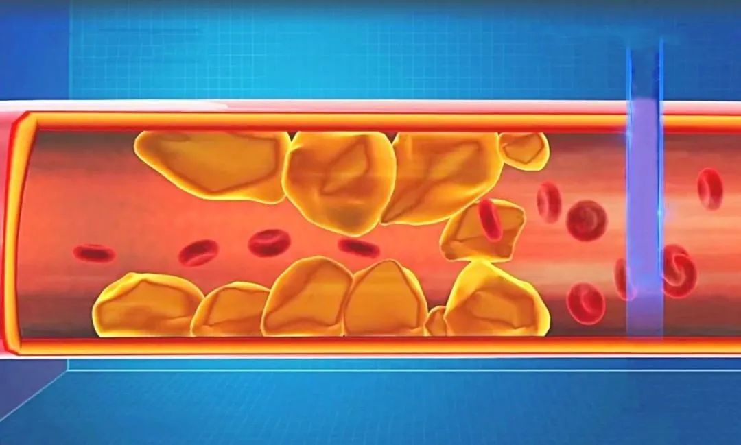 甲亢补硒的药(甲亢甲减症状区别)-硒宝网