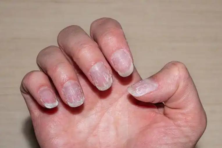 补硒能降糖吗(硒与肿瘤风险)-硒宝网