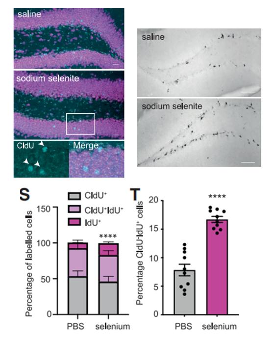 小脑萎缩补硒(硒元素与神经前体细胞增殖)-硒宝网