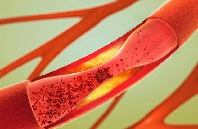 补硒药怎么吃(补硒对血管的好处)-硒宝网