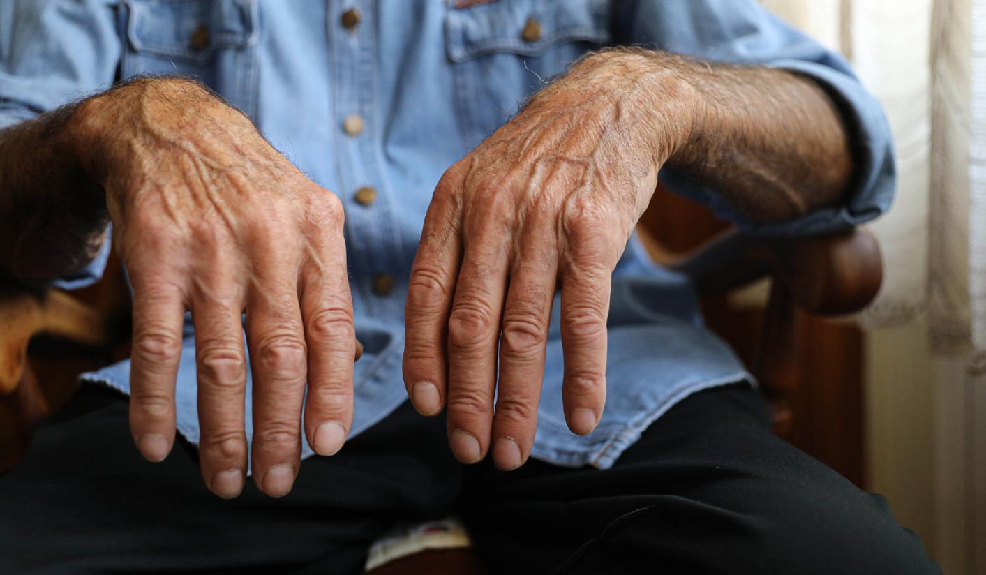 护肝如何补硒(硒缺乏症状)-硒宝网