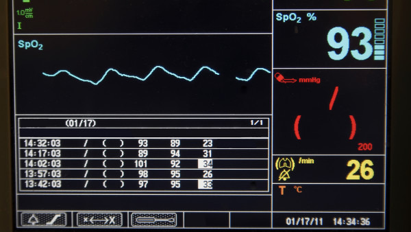 桥本需补硒吗（硒对桥本甲状腺炎的帮助）-硒宝网