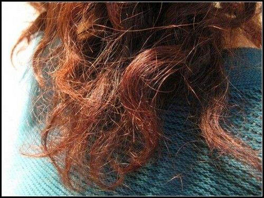 需补硒的人群(富含硒的食物有哪些)-硒宝网